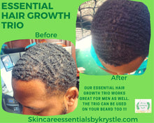 Load image into Gallery viewer, Essential Hair Growth Oil - 4oz