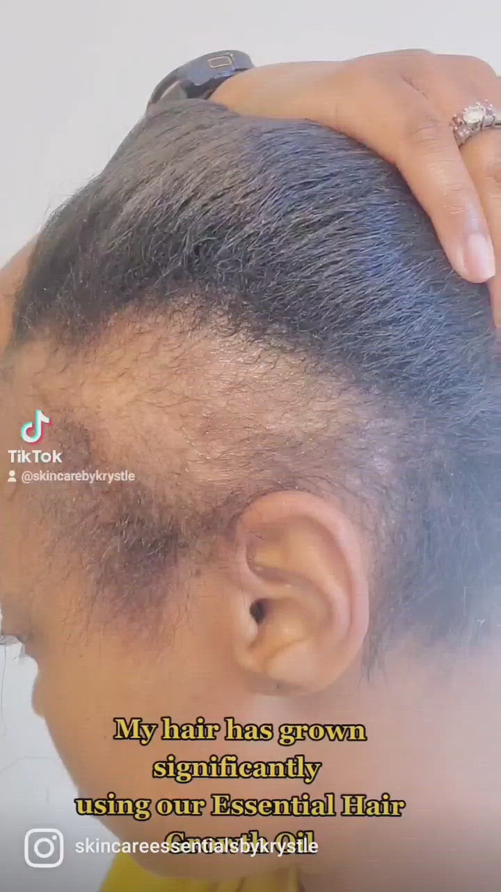 Essential Hair Growth Oil 8oz