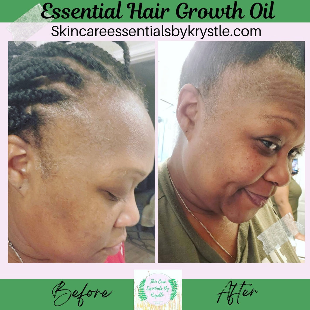 Essential Hair Growth Oil - 4oz